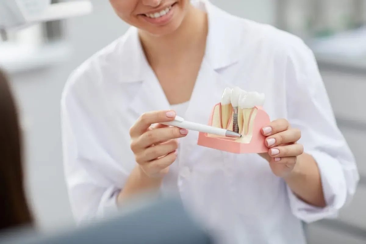 Dental Implant FAQs: Your Complete Guide