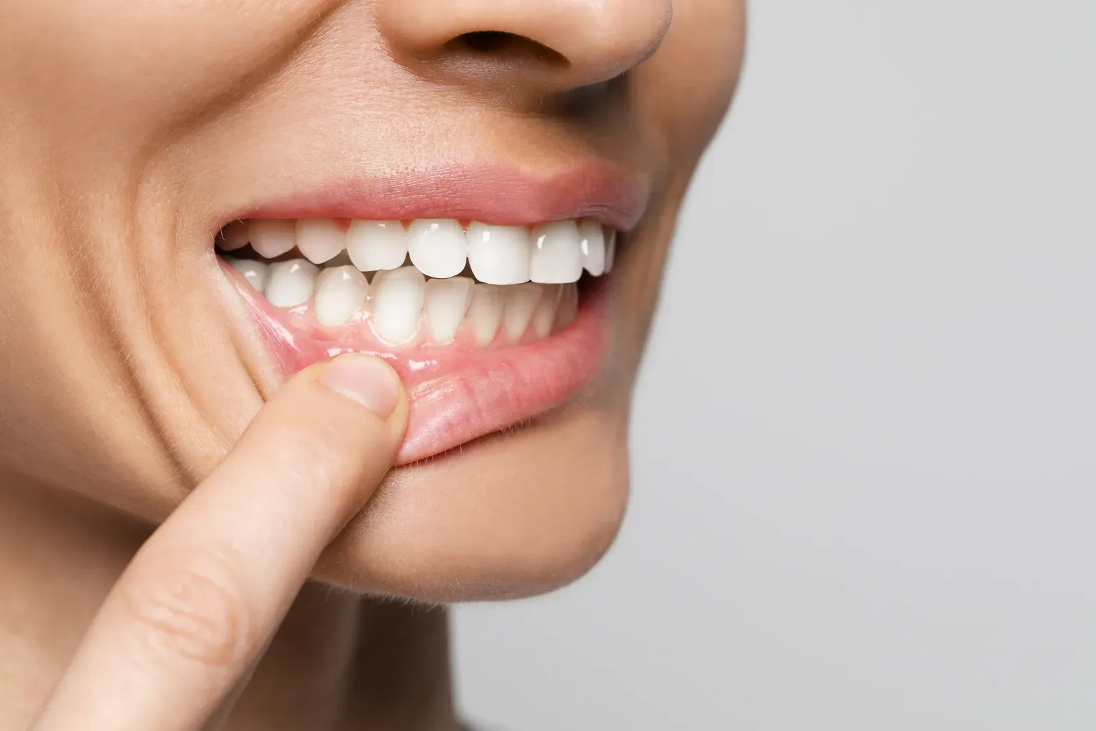 Gum Disease Treatment: Signs, Stages, and Solutions