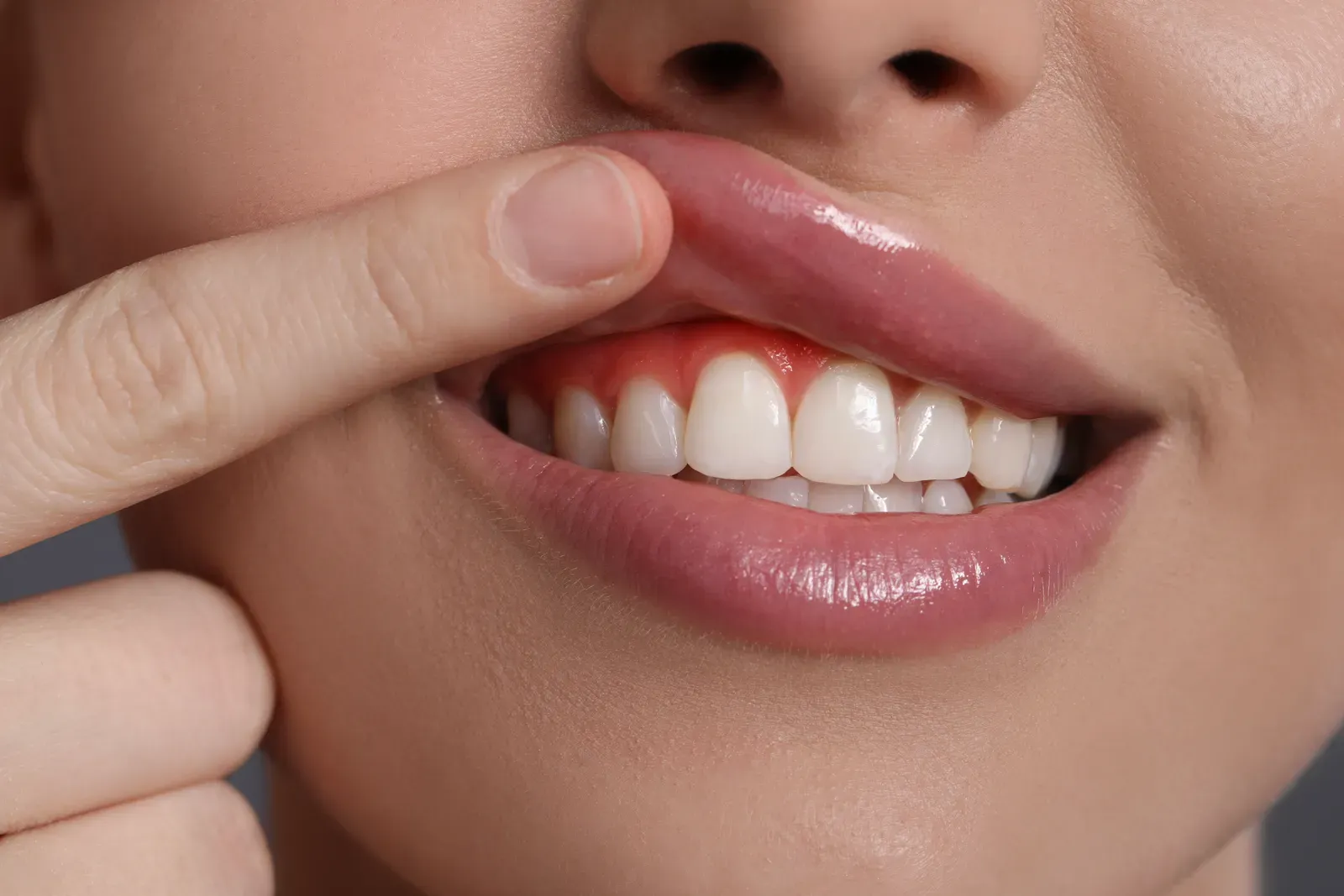 Gum Disease Treatment: Protect Your Oral Health Today